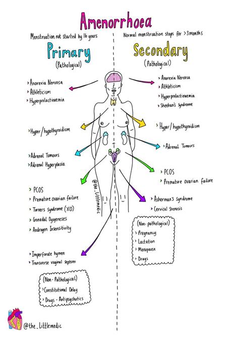 Amenorrhoea Medizzy