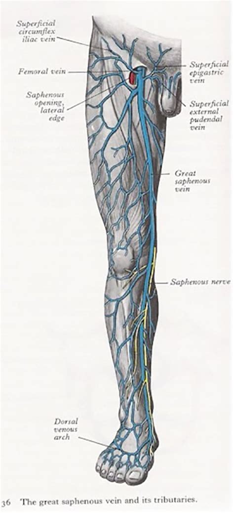 Venous Stasis And Venous Ulceration Lower Extremity Venous Disease
