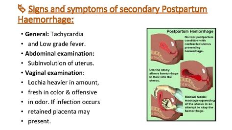 Pathophysiology Of Postpartum Hemorrhage