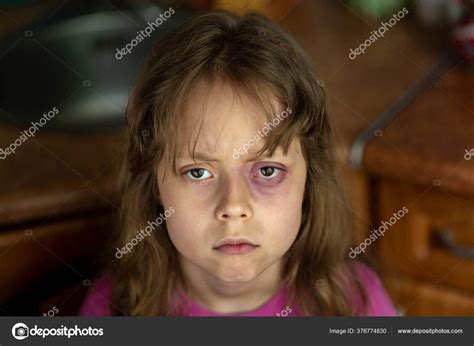 Portrait Sad Scared Little Girl Beating Child Domestic Abuse Violence