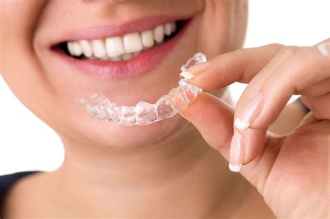 Clear Brace Smile Is A Orthodontic System That Focuses Mainly On The