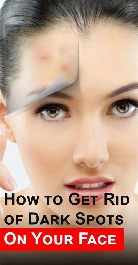 How To Get Rid Of Dark Spots On Your Face Be Queen Undereyewrinkles