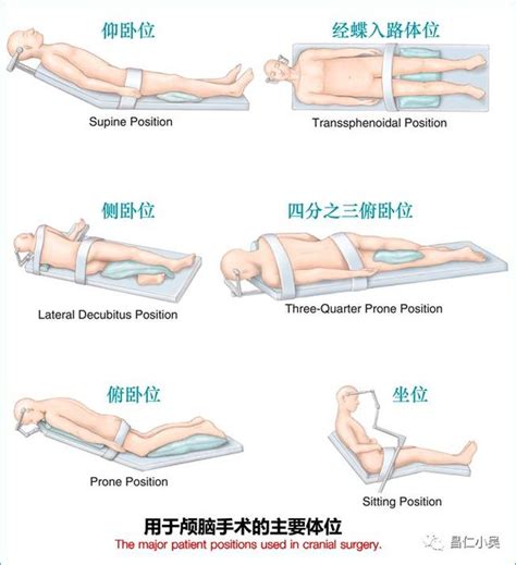 神經解剖學習筆記 神外手術的體位 每日頭條