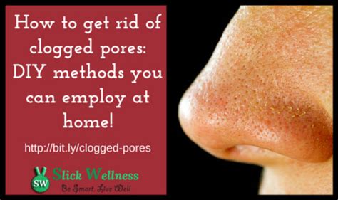 How To Get Rid Of Clogged Pores Using Diy Methods At Home
