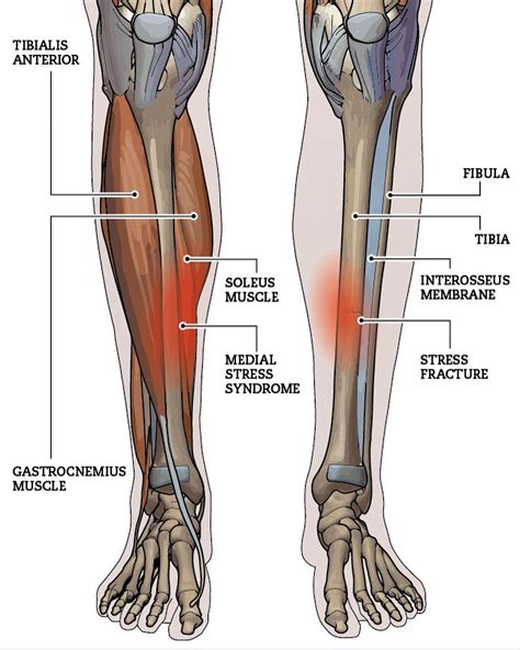 Posterior Tibial Pain