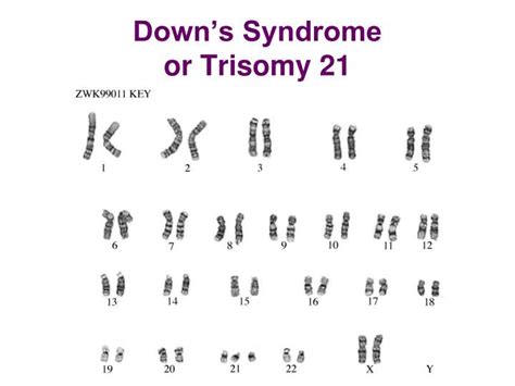 Children affected by trisomy usually have a range of there are three types of down syndrome. PPT - Chapter 14: Human Heredity (Genetics II) PowerPoint ...