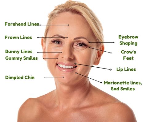 8 Types Of Wrinkles Smoothed By Botox And Dermal Fillers Advanced Skin