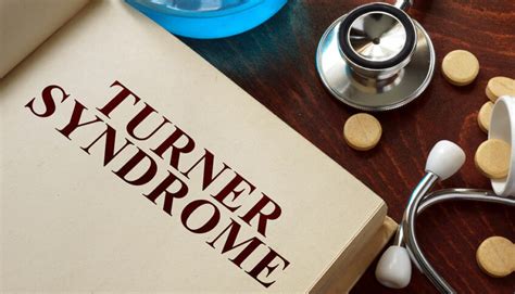 Turner Syndrome Causes Symptoms And Management Answergenius Net