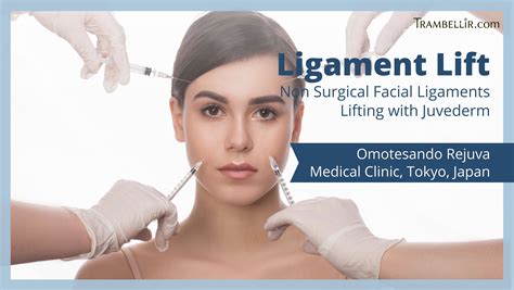 Ligament Lift Non Surgical Facial Ligaments Lifting With Juvederm