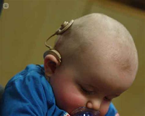 How Do Cochlear Implants Work