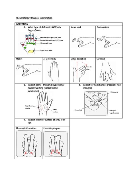 Illustrated Rheumatology Examination Finger Hand
