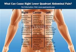 What Can Cause Right Lower Quadrant Abdominal How Is It Treated
