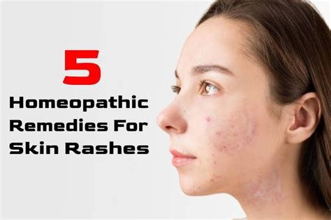 Understanding And Managing Skin Rashes Causes Symptoms And Treatments