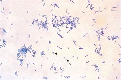 Gram Positive Rods Review Of Medical Microbiology And Immunology