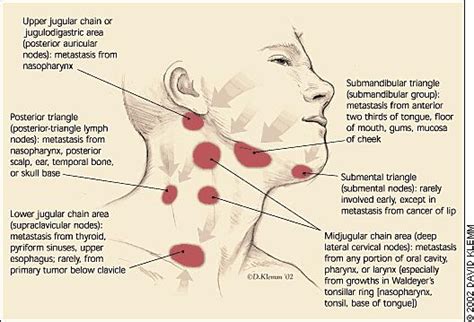 Causes Of Enlarged Lymph Nodes In Neck Things You Didnt