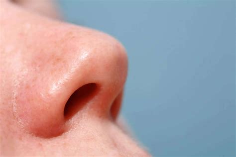 Got A Bump In Your Nose Heres What It Might Be And How To Treat It