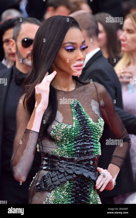 Canadian Fashion Model Winnie Harlow Poses On The Red Carpet For The
