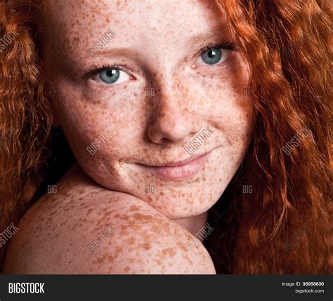 Cheerful Freckled Girl Image And Photo Free Trial Bigstock