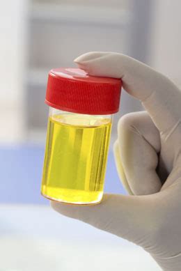 Bright yellow urine is common when taking a vitamin b complex, specifically due to the b2 vitamin, also known as riboflavin. Your Urine Color Can Reveal Your Health Issues