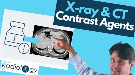 Contrast Agents In X Ray And Ct Scans What You Need To Know Youtube