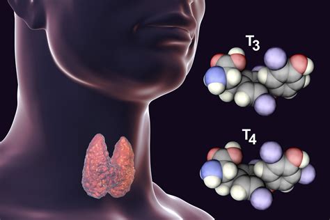Thyroiditis Overview And More