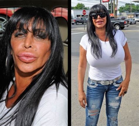 21 Celebrity Plastic Surgery Nightmares: Before & After ...