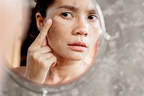 Premature Skin Aging What Can Cause It Revoada