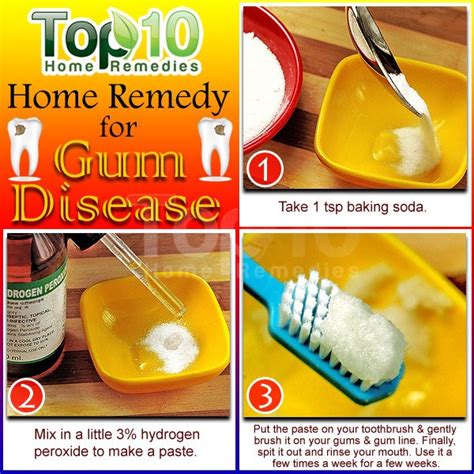 Home Remedies For Gum Disease Top 10 Home Remedies