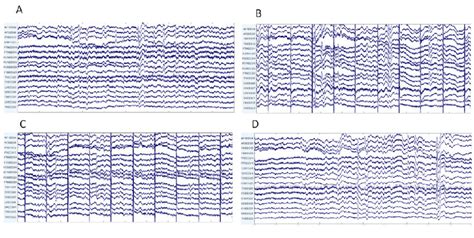 Representative Electroencephalography Eeg Excerpts From The Four