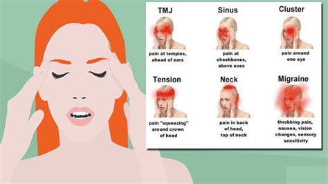 Headache Chart Top Of Head What Does A Headache On The Top Of The Head Indicate