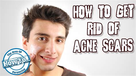 Aug 19, 2020 · topical retinoids. how to get rid of acne scars ?! - YouTube
