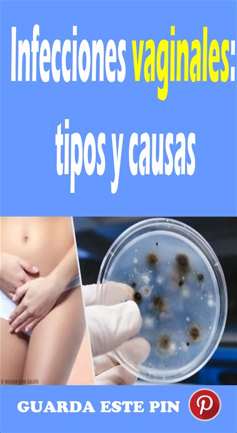 Conozca Las Causas De Las Infecciones Vaginales Vida Peru My Xxx Hot Girl
