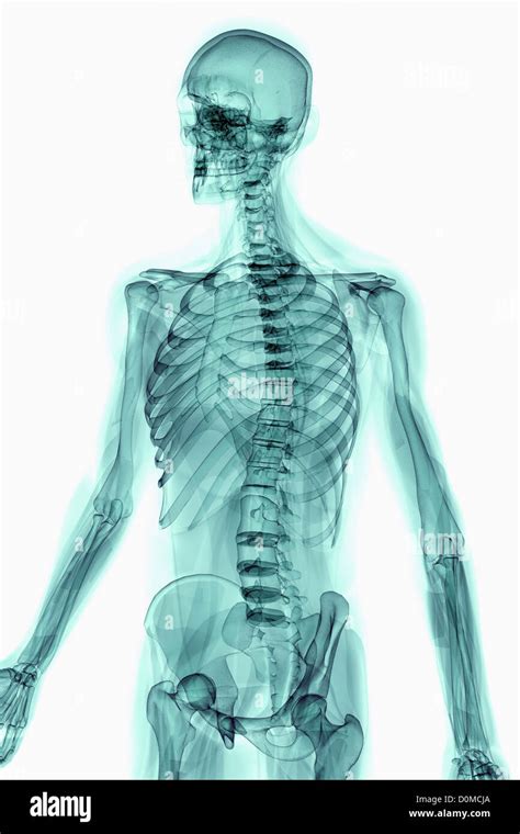 X Ray Image Showing The Rib Cage And Pelvis Stock Photo Alamy