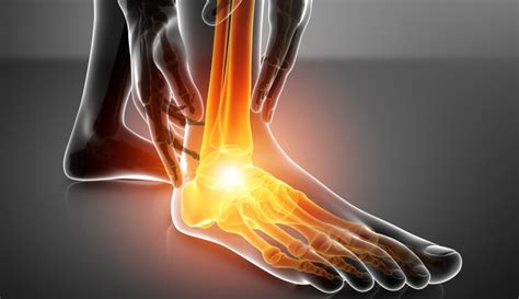 Ankle Injection What Are The Options For Ankle Arthritis