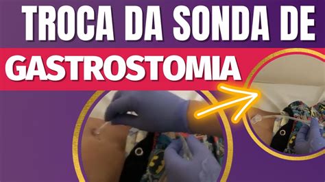 O Que Significa Gtt Na Enfermagem