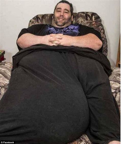 Man With 100 Pound Scrotum Is Raising Money For Risky Surgery And His Loyal Wife Is Sticking