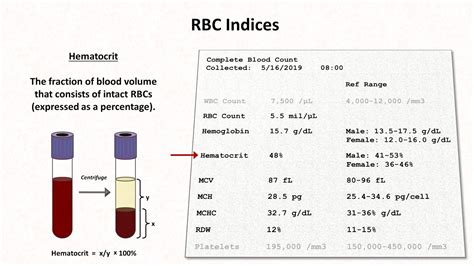 How To Interpret Rbc Indices E G Hemoglobin Vs Hematocrit Mcv Rdw