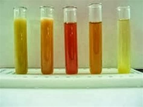 What The Colour Of Your Urine Says About Your Health Passnownow
