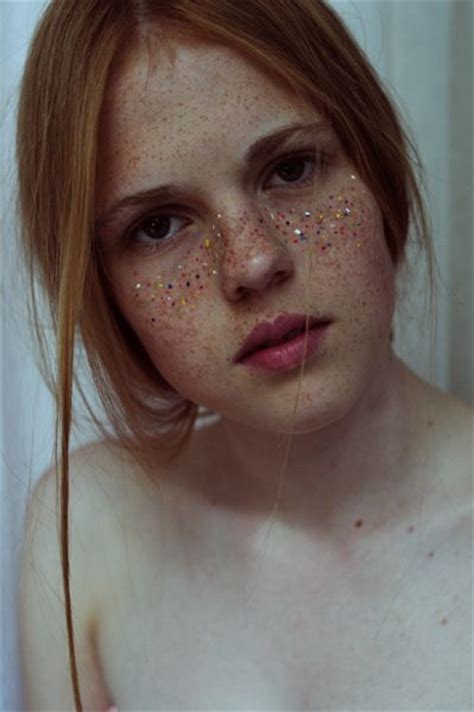 Freckle Faced Beautyor Not