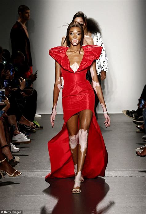 Winnie Harlow Commands The Catwalk At Laquan Smith Show At Nyfw Daily