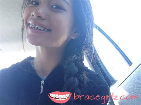 Another Cute Asian Braces Girl Bracegirlz Com Image On Favim Com