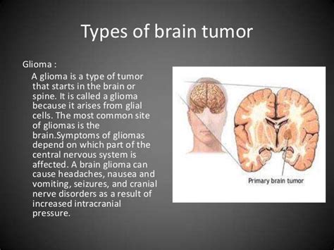 Brain Cancer Prognosis