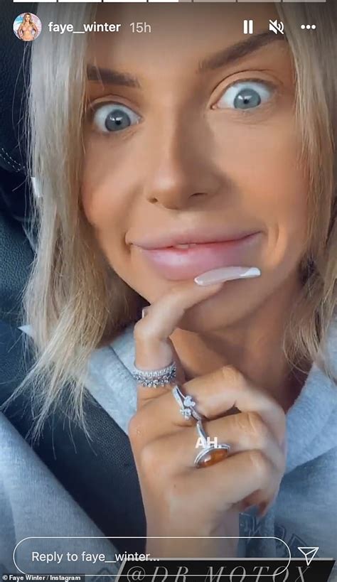 love island s faye winter shows off her natural lips after getting her fillers temporarily