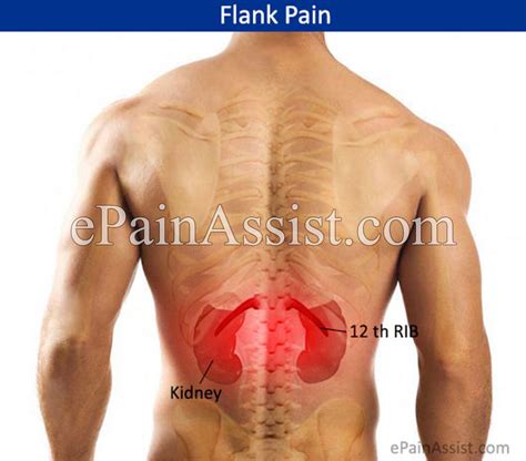 The ribcage is a part of the skeleton of humans and some animals. What Can Cause Pain in the Flank Region?