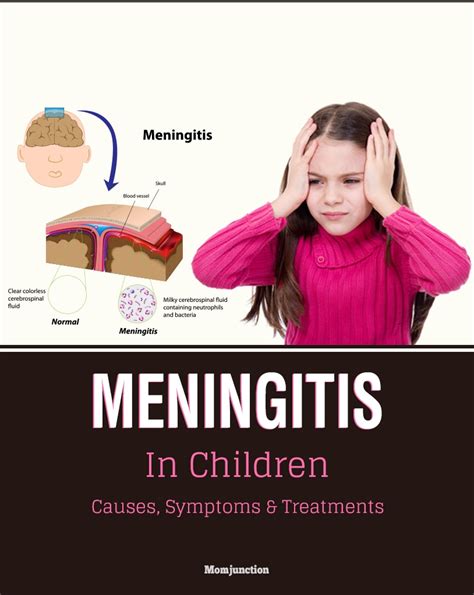 Meningitis In Children Causes Symptoms And Treatment