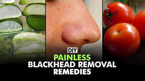 Home Remedies To Remove Blackheads Diy Fit Tak Youtube