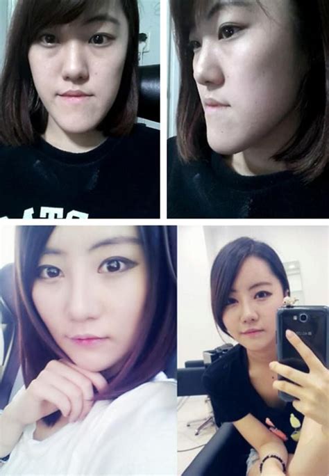 Plastic Surgery Before And After Korean Celebrities Diet Creditinter