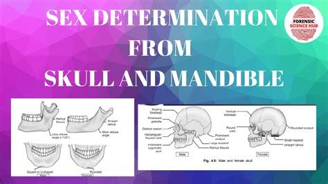 Sex Determination Through Skull And Mandible Forensic Medicine Youtube