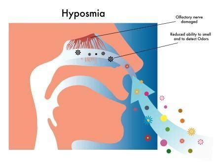 The polyps can develop at different sites in the cavities. Anosmia: Ayurvedic Treatment And Home Remedies