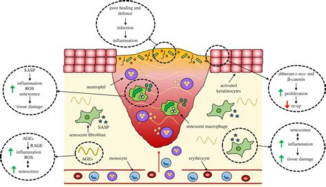 Wound Healing Cellular Mechanisms And Pathological Outcomes Open Biology